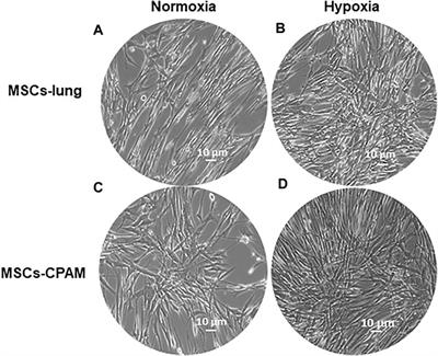 The Role of Hypoxia in Improving the Therapeutic Potential of Mesenchymal Stromal Cells. A Comparative Study From Healthy Lung and Congenital Pulmonary Airway Malformations in Infants